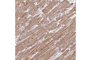 Immunohistochemical staining of human heart muscle shows moderate cytoplasmic positivity in myocytes.