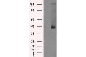 Western Blotting (WB) image for anti-Lysyl Oxidase (LOX) (AA 22-168) antibody (ABIN1491219) (LOX Antikörper  (AA 22-168))