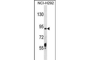 TRSS6 Antibody (N-term) (ABIN1881891 and ABIN2838364) western blot analysis in NCI- cell line lysates (35 μg/lane). (TMPRSS6 Antikörper  (N-Term))