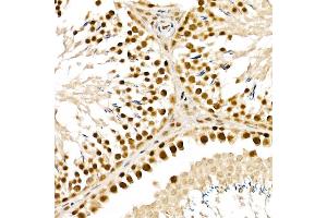 Immunohistochemistry of paraffin-embedded rat testis using  Rabbit pAb (ABIN6133085, ABIN6136806, ABIN6136807 and ABIN6215376) at dilution of 1:150 (40x lens). (ALKBH5 Antikörper  (AA 245-394))