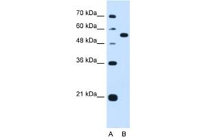WB Suggested Anti-LMAN1 Antibody Titration:  1. (LMAN1 Antikörper  (Middle Region))