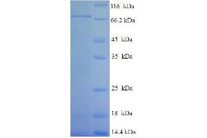 SDS-PAGE (SDS) image for Tektin 5 (TEKT5) (AA 1-485), (full length) protein (His-SUMO Tag) (ABIN5711717) (TEKT5 Protein (AA 1-485, full length) (His-SUMO Tag))