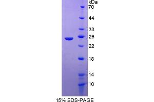 Image no. 1 for Formin Binding Protein 1 (FNBP1) (AA 348-529) protein (His tag) (ABIN4989287)
