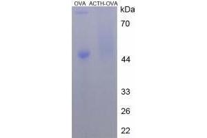 Image no. 2 for Adrenocorticotropic hormone (ACTH) peptide (Ovalbumin) (ABIN5666063) (Adrenocorticotropic hormone (ACTH) peptide (Ovalbumin))