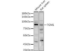 Western blot analysis of extracts of various cell lines, using TGM1 antibody (ABIN6129517, ABIN6149090, ABIN6149092 and ABIN6217322) at 1:1000 dilution. (TGM1 Antikörper  (AA 100-280))