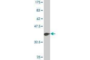 Western Blot detection against Immunogen (36. (p300 Antikörper  (AA 731-830))