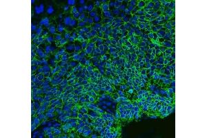 anti-Basigin (Ok Blood Group) (BSG) (AA 138-323) antibody