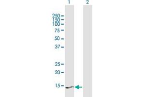 Western Blot analysis of PRY2 expression in transfected 293T cell line by PRY2 MaxPab polyclonal antibody. (PRY2 Antikörper  (AA 1-147))