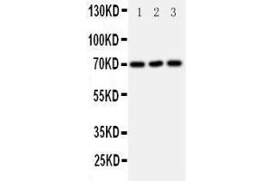 Western Blotting (WB) image for anti-Solute Carrier Family 6 (Neurotransmitter Transporter, serotonin), Member 4 (SLC6A4) (AA 7-24), (N-Term) antibody (ABIN3043084) (SLC6A4 Antikörper  (N-Term))