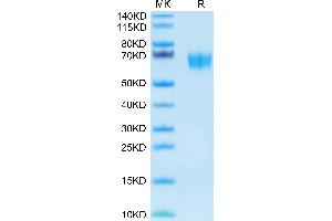 alpha 2 Antiplasmin Protein (AA 28-491) (His tag)