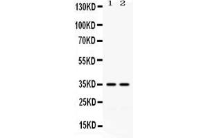 Western blot analysis of LFA3 expression in HELA whole cell lysates ( Lane 1) and K562 whole cell lysates ( Lane 2). (CD58 Antikörper  (AA 29-215))