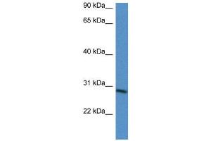 WB Suggested Anti-BARX2  Antibody Titration: 0. (BARX Homeobox 2 Antikörper  (N-Term))