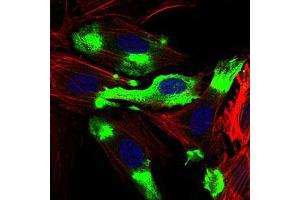 Immunofluorescence analysis of Hela cells using CD22 mouse mAb (green). (CD22 Antikörper  (AA 621-725))