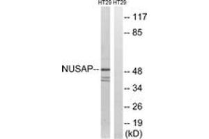 Western blot analysis of extracts from HT-29 cells, using NUSAP1 Antibody. (NUSAP1 Antikörper  (AA 392-441))