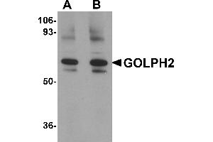 Western Blotting (WB) image for anti-Golgi Membrane Protein 1 (GOLM1) (Middle Region) antibody (ABIN1030941)