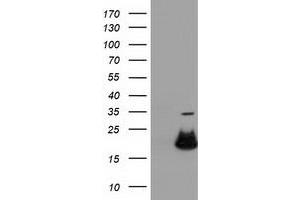 Western Blotting (WB) image for anti-Retinoblastoma Binding Protein 9 (RBBP9) antibody (ABIN1500628) (RBBP9 Antikörper)
