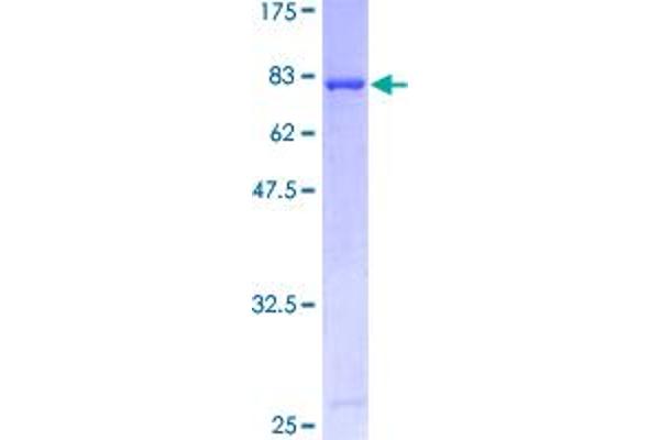 p53 Protein (AA 1-393) (GST tag)