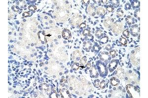 ZBTB9 antibody was used for immunohistochemistry at a concentration of 4-8 ug/ml to stain Epithelial cells of renal tubule (arrows) in Human Kidney.