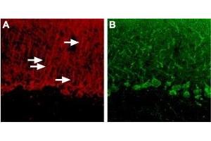 Immunohistochemistry (IHC) image for anti-Pyrimidinergic Receptor P2Y, G-Protein Coupled, 4 (P2RY4) (AA 337-350), (Intracellular) antibody (ABIN7043589)