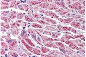 Human Heart (formalin-fixed, paraffin-embedded) stained with DCLRE1A antibody ABIN291867 at 2. (SNM1 Antikörper  (AA 1032-1044))