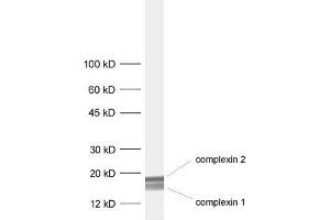 dilution: 1 : 1000, sample: rat brain homogenate (Complexin 1, 2 (C-Term) Antikörper)