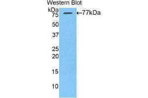 Western Blotting (WB) image for anti-Angiotensinogen (serpin Peptidase Inhibitor, Clade A, Member 8) (AGT) (AA 35-485) antibody (ABIN1857947) (AGT Antikörper  (AA 35-485))