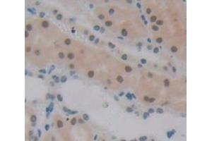 IHC-P analysis of Human Tissue, with DAB staining. (Polybromo 1 Antikörper  (AA 957-1086))