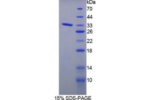 Image no. 1 for Protein tyrosine Phosphatase, Receptor Type, J (PTPRJ) (AA 1033-1277) protein (His tag) (ABIN6238042) (PTPRJ Protein (AA 1033-1277) (His tag))