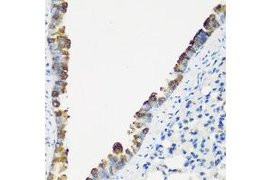 Immunohistochemistry of paraffin-embedded mouse lung using TNNC2 antibody at dilution of 1:200 (40x lens). (TNNC2 Antikörper)