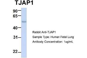 Host:  Rabbit  Target Name:  TJAP1  Sample Type:  Human Fetal Lung  Antibody Dilution:  1. (TJAP1 Antikörper  (N-Term))