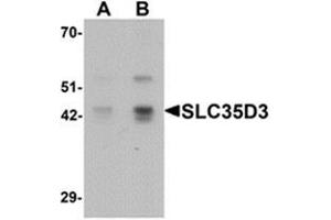 Western blot analysis of SLC35D3 in HeLa cell lysate with SLC35D3  at (A) 1 and (B) 2 ug/ml.