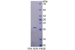 SDS-PAGE analysis of Mouse TBCA Protein. (TBCA Protein)