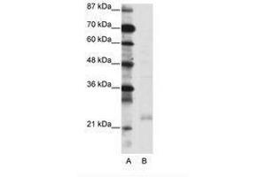 Image no. 1 for anti-TAF10 RNA Polymerase II, TATA Box Binding Protein (TBP)-Associated Factor, 30kDa (TAF10) (C-Term) antibody (ABIN6736086) (TAF10 Antikörper  (C-Term))