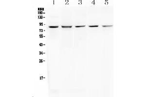 Western blot analysis of RNF43 using anti-RNF43 antibody .