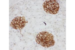 Anti-CD34 antibody, IHC(F) IHC(F): Rat Kidney Tissue (CD34 Antikörper  (C-Term))