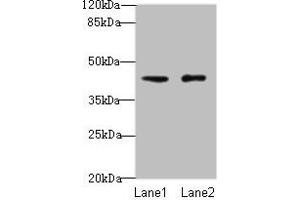 Western blot All lanes: VPS45 antibody at 3 μg/mL Lane 1: Mouse brain tissue Lane 2: U87 whole cell lysate Secondary Goat polyclonal to rabbit IgG at 1/10000 dilution Predicted band size: 66, 62 kDa Observed band size: 41 kDa (VPS45 Antikörper  (AA 101-400))