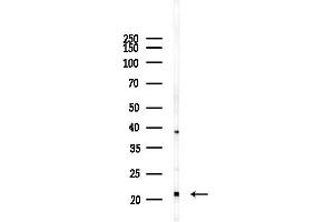 anti-Mitochondrial Ribosomal Protein L18 (MRPL18) antibody