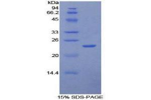 SDS-PAGE (SDS) image for Intercellular Adhesion Molecule 4 (ICAM4) (AA 52-234) protein (His tag) (ABIN2125362)