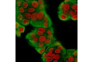 Immunofluorescence Analysis of MeOH-fixed Human MCF-7 cells labeling CK with Multi-Cytokeratin Recombinant Rabbit Monoclonal Antibody (KRT/1877R)followed by Goat anti-Mouse IgG-CF488 (Green). (Rekombinanter Cytokeratin, Multi (Epithelial Marker) Antikörper)