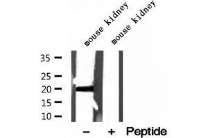 Western blot analysis of extracts of mouse kidney tissue, using MPV17 antibody. (MPV17 Antikörper  (Internal Region))