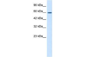 WB Suggested Anti-ZNF12 Antibody Titration:  1. (ZNF12 Antikörper  (N-Term))
