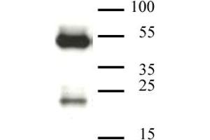 CAF-1 p60 antibody (mAb) tested by Western blot. (CHAF1B Antikörper)