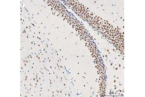 IHC analysis of DDX1 using anti-DDX1 antibody (ABIN7602052).
