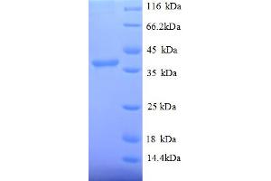 SDS-PAGE (SDS) image for Signal Recognition Particle 14kDa (Homologous Alu RNA Binding Protein) (SRP14) (AA 2-108), (partial) protein (GST tag) (ABIN4976428)