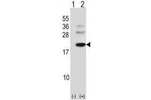 Western blot analysis of BARX1 (arrow) using rabbit polyclonal BARX1 Antibody (C-term) .