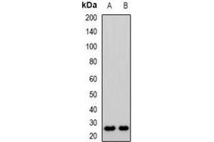 Western blot analysis of CD53 expression in KB (A), Jurkat (B) whole cell lysates. (CD53 Antikörper)