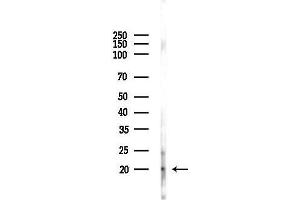anti-Dual Specificity Phosphatase 3 (DUSP3) (N-Term) antibody