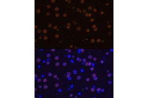 Immunofluorescence analysis of mouse brain using MEF2C Polyclonal Antibody (ABIN6132345, ABIN6143716, ABIN6143717 and ABIN6215998) at dilution of 1:100 (40x lens). (MEF2C Antikörper  (AA 170-380))