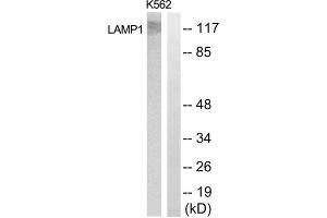 Western blot analysis of extracts from K562 cells, using LAMP1 antibody. (LAMP1 Antikörper  (Internal Region))