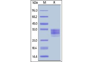 Mouse CD16-2, His Tag on  under reducing (R) condition. (Fc gamma RIV / CD16-2 (AA 21-203) protein (His tag))